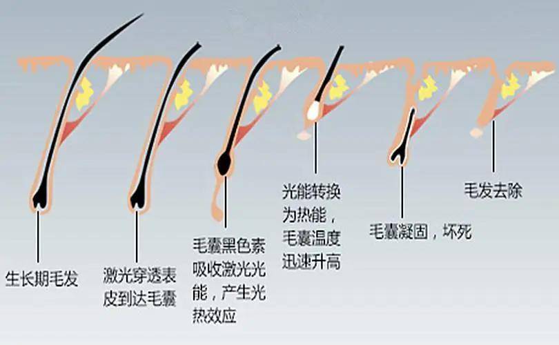 有手毛怎么办