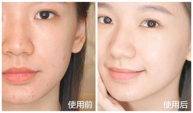 怎样能让皮肤透亮 718c10cfce8c4aab9dd149f89003d13e.jpeg