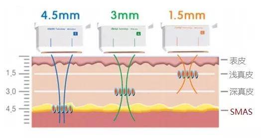 网友|高圆圆复出有点坎坷，产后1年首次亮相网友们为这生图吵翻天！