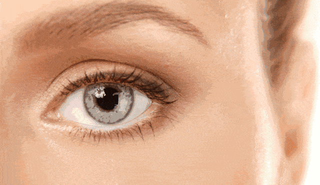 女明星|女明星“眼下增肥”是什么操作？