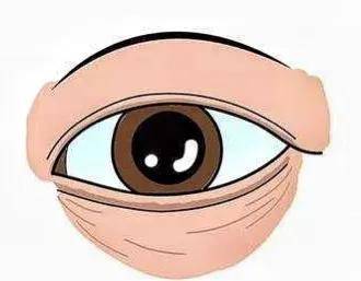 女明星|女明星“眼下增肥”是什么操作？