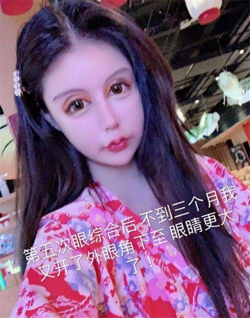 母亲|女孩为了变美，花100万疯狂整容，扬言母亲支持，前后对比如换脸