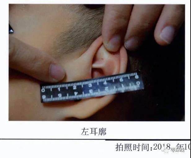 触目惊心!天津“针扎虐童案”一审宣判:3幼教不认罪,法院采信幼儿证言 触目惊心!天津“针扎虐童案”一审宣判:3幼教不认罪,法院采信幼儿证言