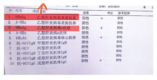 3, 乙肝病毒dna 100 iu/ml