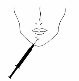 皮肤保养正确步骤教程 31c8c6527b20469db7a52d32ce8a8904.png