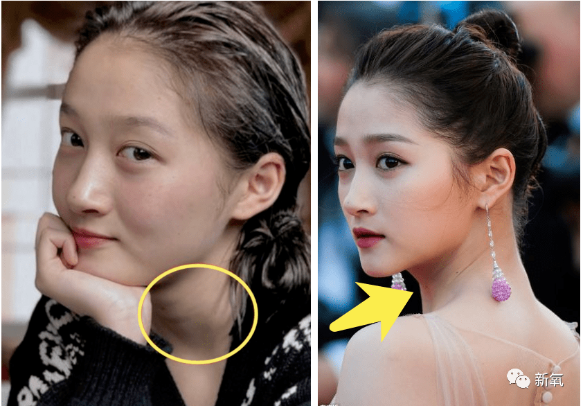 高大壮|一直被diss高大壮的关晓彤暗戳戳动了这里，突然仙到飞起！