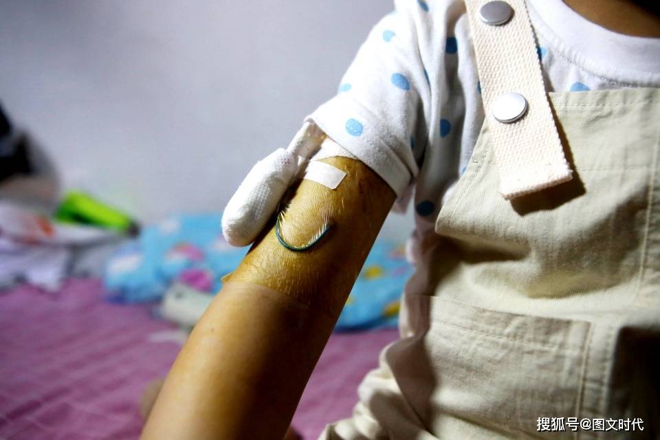 欠费|她含泪求妈妈放弃,母女俩抱头痛哭血癌女童因欠费17万被迫出院