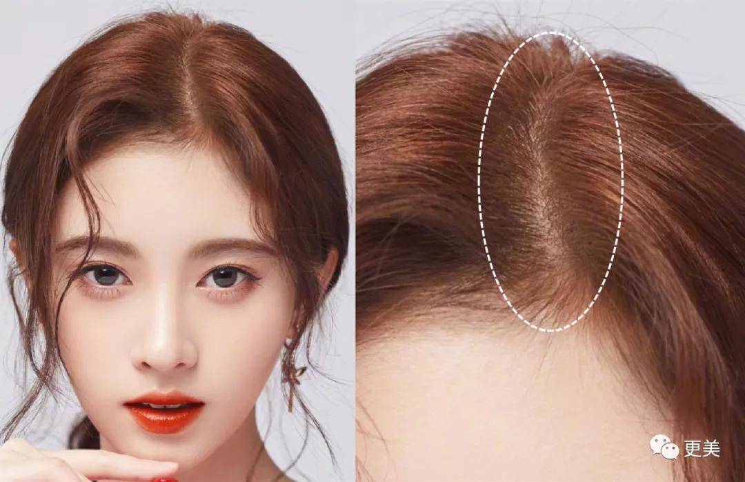 刘海|当毛发都在伪造的鞠婧祎失去刘海，场面瞬间窒息！