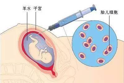 多少周做无创和羊水穿刺 2c102d9b32154b7f998747e6470ad6f3.jpeg
