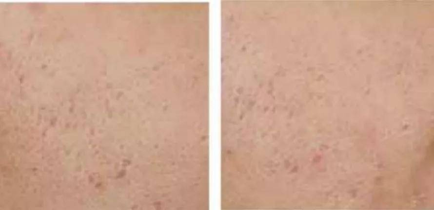 镜子|以前拿央视镜头当镜子，现在十级滤镜都磨不平，刘亦菲鼻子到底咋了？