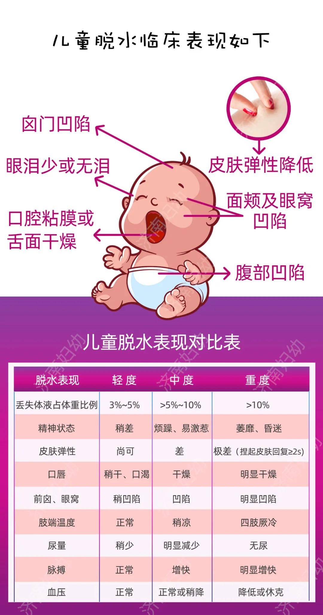 宝宝腹泻莫着急,儿科医生告诉你_脱水