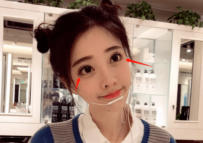 do|冯提莫这是后遗症出来了还是do了两次？搞成猪鼻子了…