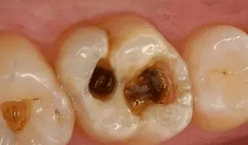 &quot|广州圣贝儿牙科普 | 返校复学，孩子的牙齿都＂整顿＂好了么？