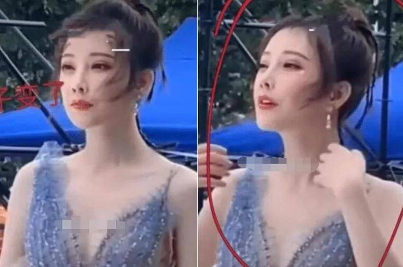 do|冯提莫这是后遗症出来了还是do了两次？搞成猪鼻子了…