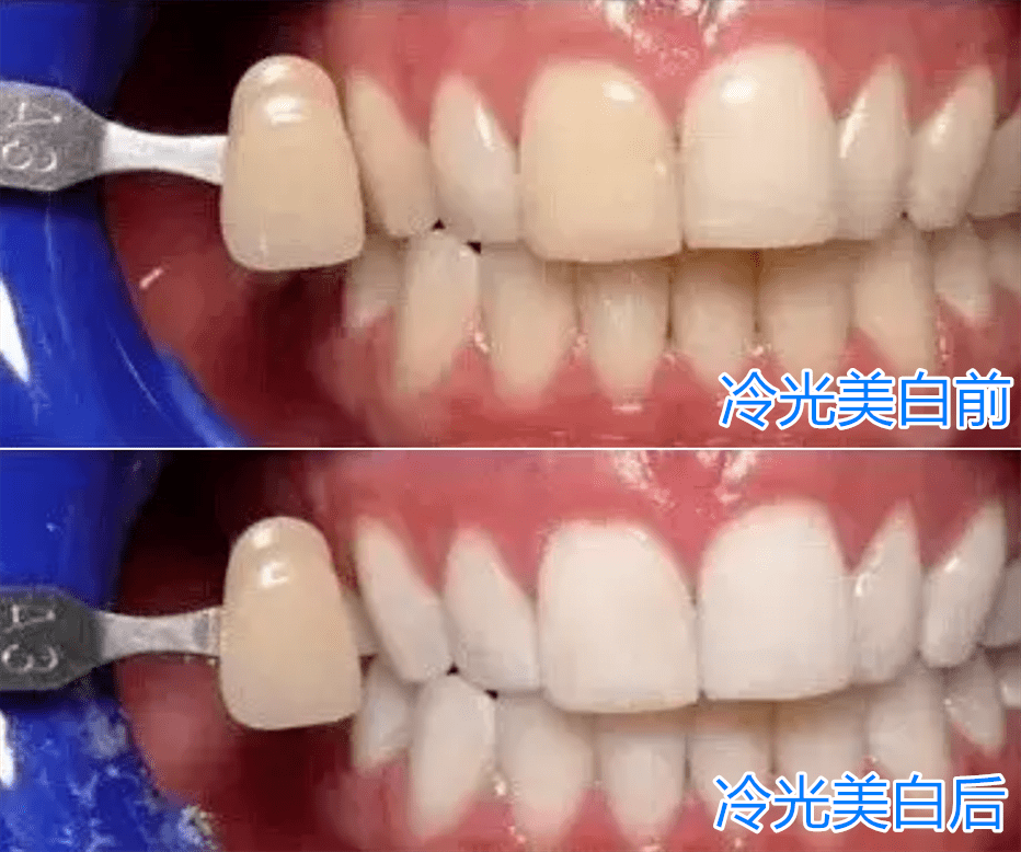 供养|没了红气供养的范冰冰眼里星光黯淡，复出之路还接遭网红拉踩？