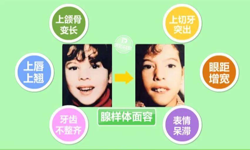 智商|这件事影响颜值和智商打呼噜是睡得香？家有孕妈和宝宝注意了