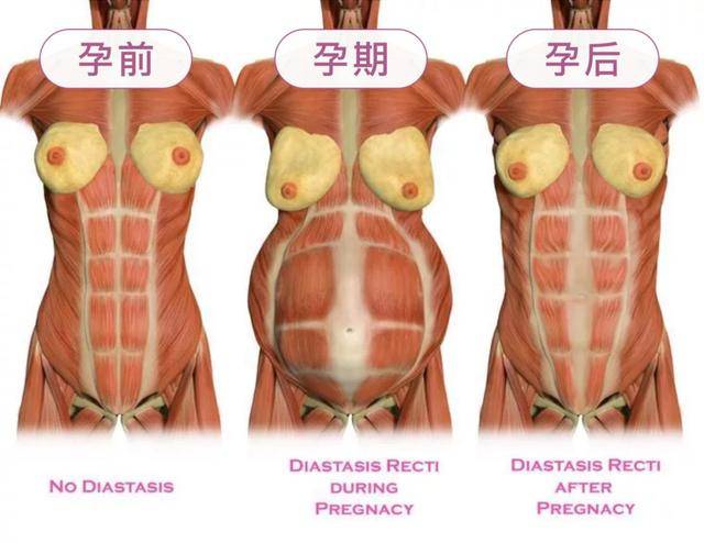 怎么把肚子上的肉转移到胸上 dd0762cce5eb4bdb8cdd7671d4e6a3b9.jpeg