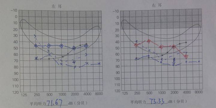 坡度怎么算大 b30ef5b287184ac6836d35ad01bc3d39.jpeg