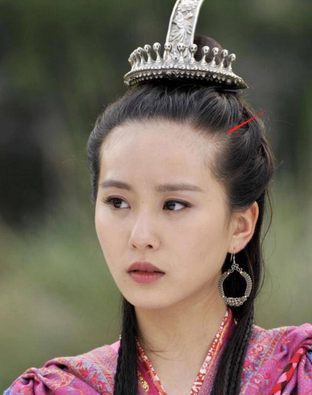 发际线|长得好看都难逃秃头？刘诗诗旧照被扒也秃头，跟杨幂鞠婧祎有一拼
