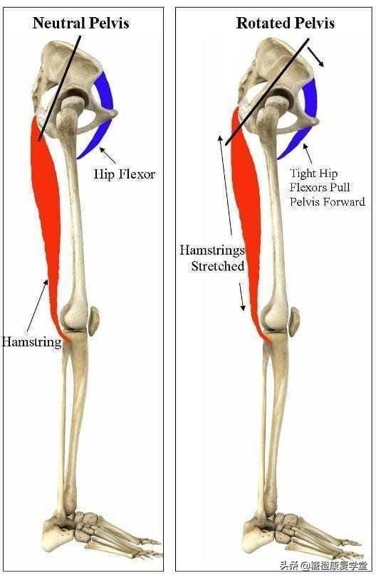 骨盆后倾:腘绳肌,臀大肌,腹肌