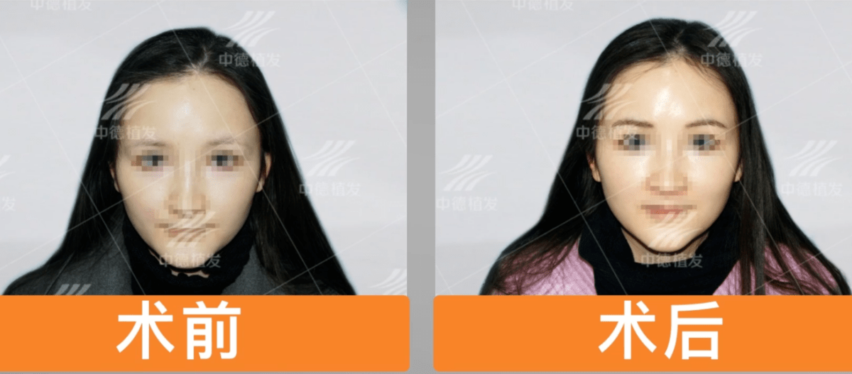 7eed864ade9143ab837b9ed84540c56f.png