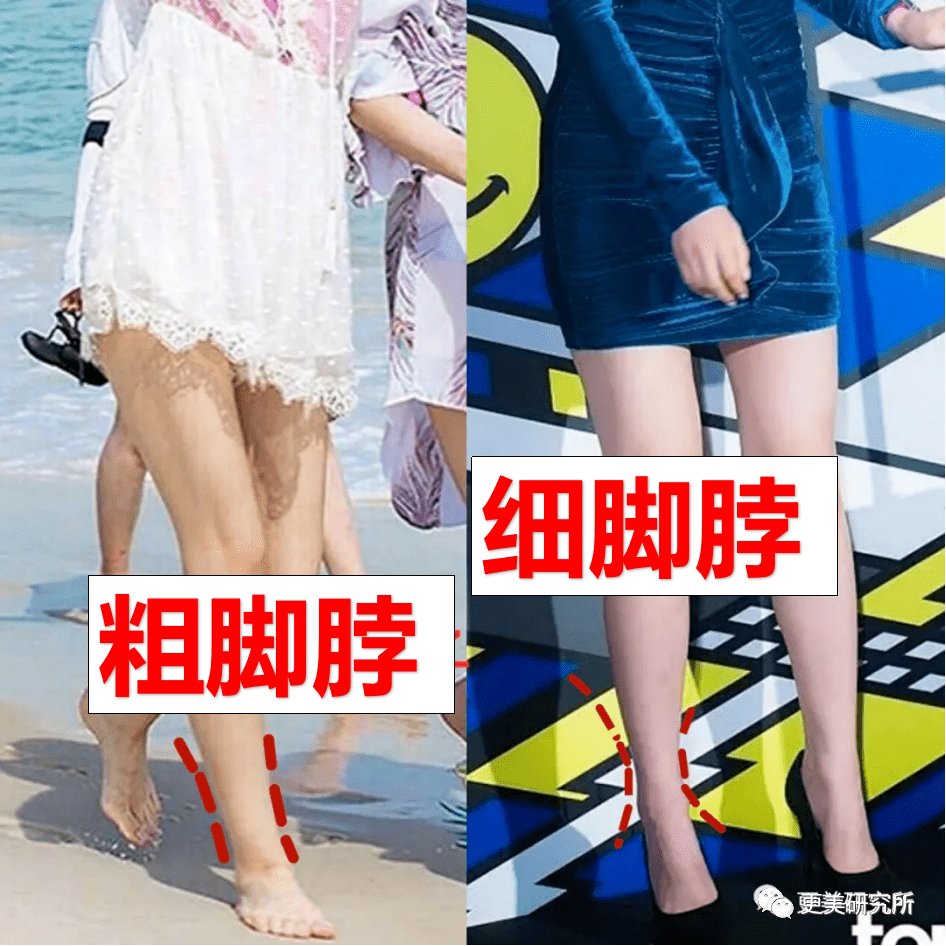 脂肪|鞠婧祎再花70w能do成迪丽热巴的前凸后翘？！