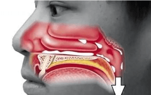 清鼻堂:鼻甲肥大的症状主要有哪些?