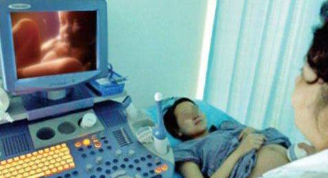 几个月胎儿有羊水 2c4b4f3660604119a911afcf82712026.jpeg