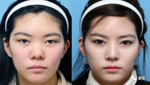 do|胖成球，眼睛do到快掉出眼眶，周杰伦最美“前女友”咋了...