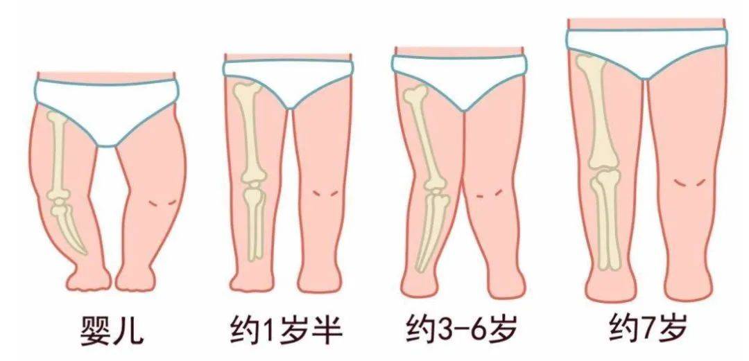 孩子|1岁前这4个行为要避免！想要宝宝以后是“大长腿”