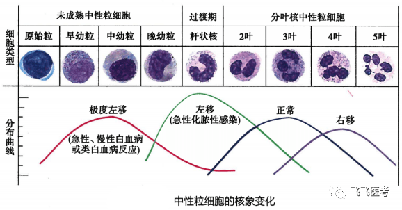 核左移，核右移，是啥？解读中性粒细胞升高与降低！