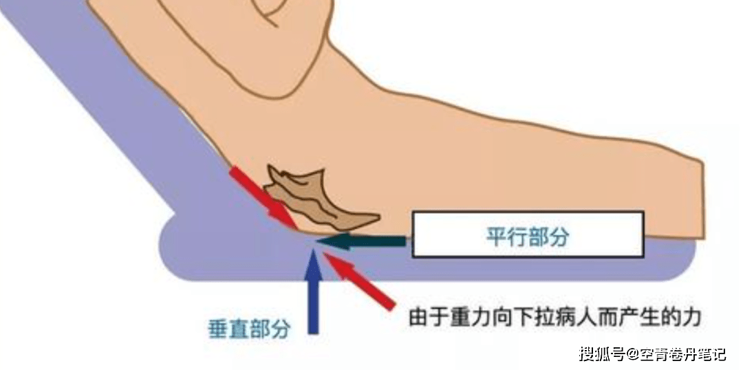 压疮愈合不仅体现护理技术更在悉心呵护