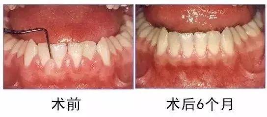 4765e154e2db4004aa4b7d50d496a363.jpeg