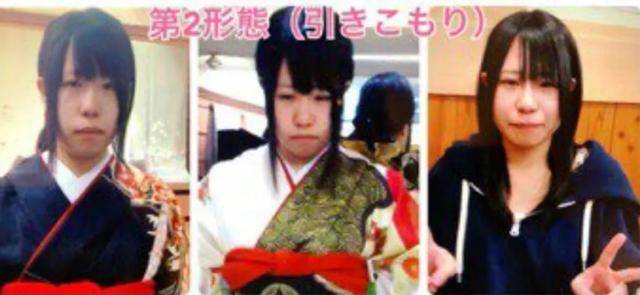 欺凌|长得丑被欺凌，日本妹子花400万成功“换头”，实现人生逆袭！