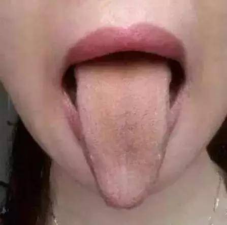 c0a7be19b2d6434d8f425d7174fdbb6d.jpeg