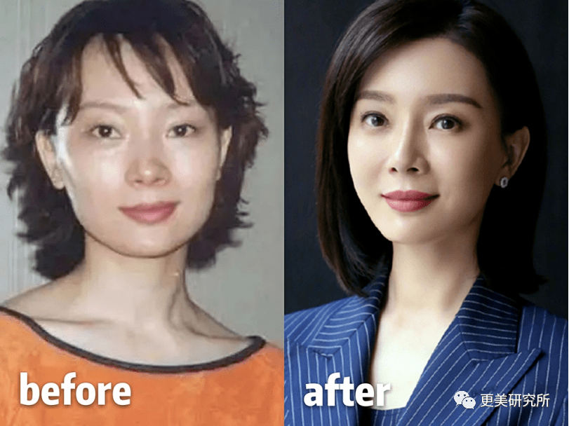 do|贵圈削骨图鉴 | 三代100个女星同时削掉半张脸、杨幂竟还垫底...