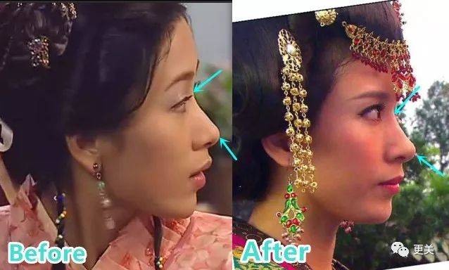 杨怡|曾经tvb一姐，演技一流，也把自己整僵了，假体太明显了...