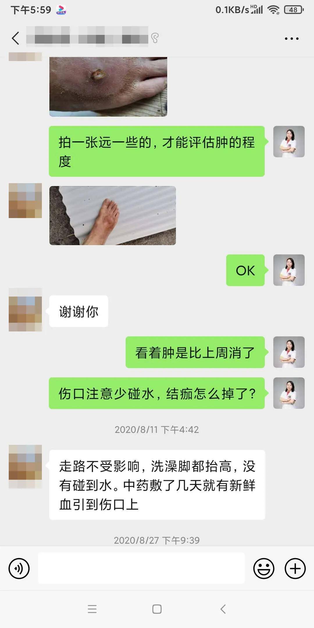 外伤脚肿怎么办