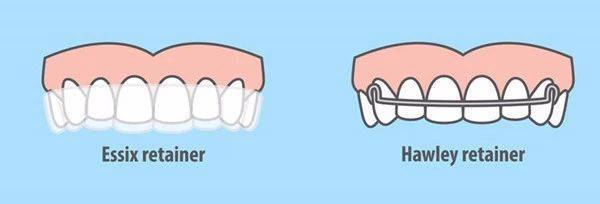 常与透明保持器一起使用,夜间戴hawley保持器,白天戴透明保持器.