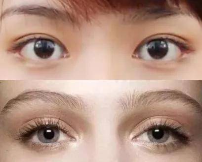 朴敏英|9年换5次头，do得毫无痕迹，双眼皮竟然还都是亲爸割的...