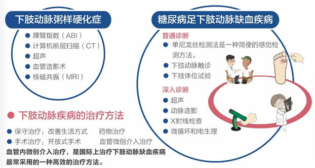 疾病|广安门医院举办“周围血管疾病义诊宣传日”系列活动