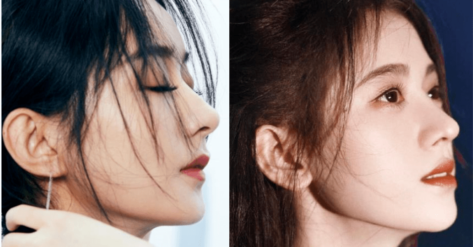 赵丽颖|鞠婧祎和赵丽颖竟然是同一个医生？