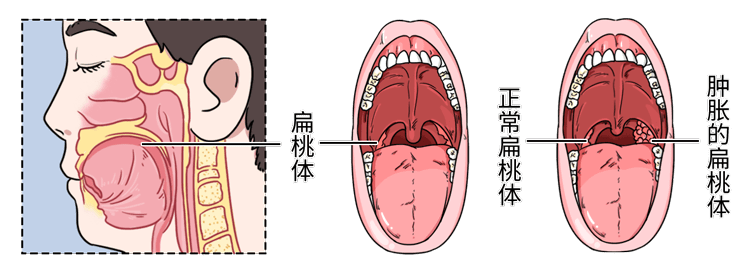 兔牙怎么办