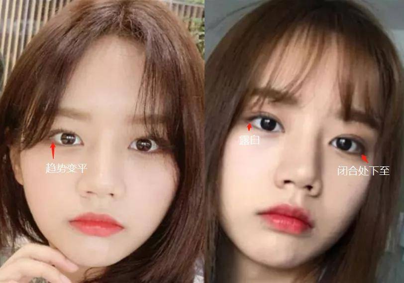 李惠利|女明星最绝大鼻头变身记！娜扎do鼻子前应该找她取经1000次...