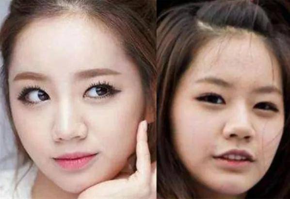 李惠利|女明星最绝大鼻头变身记！娜扎do鼻子前应该找她取经1000次...