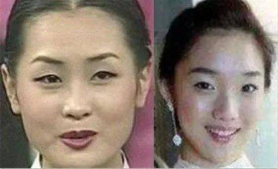 李惠利|女明星最绝大鼻头变身记！娜扎do鼻子前应该找她取经1000次...