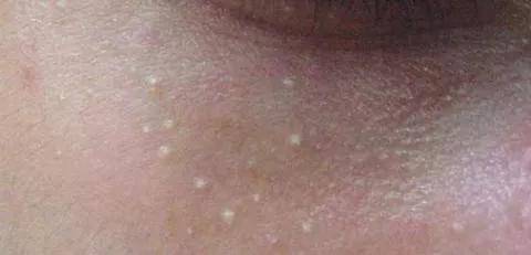 眼睛|300亿纯天然公主“下嫁”3年,40岁生两女还艳压无数小花