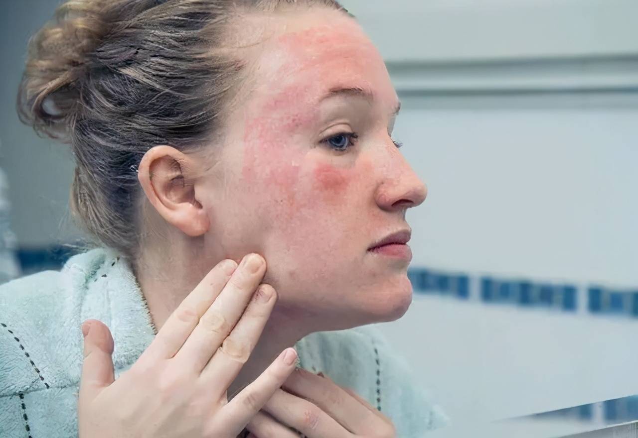 怎么判定自己是敏感肌 fdf60ce71f36437ab483f43d32cb0a16.jpeg