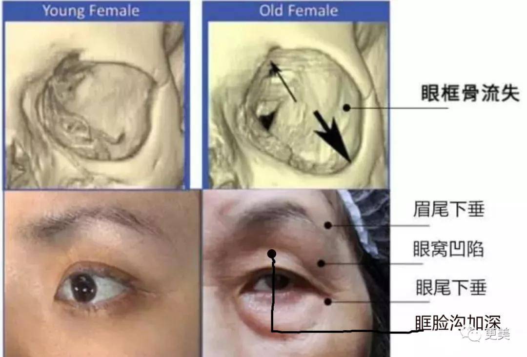 面部|韩国小姐冠军出炉，和王思聪前女友撞医生，才22岁就老了...