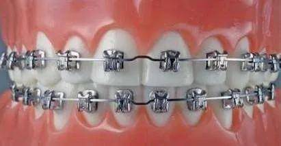 手术|杨幂关晓彤杠上了？撞衫尴尬就算了，还被网友喷做了直腿手术…